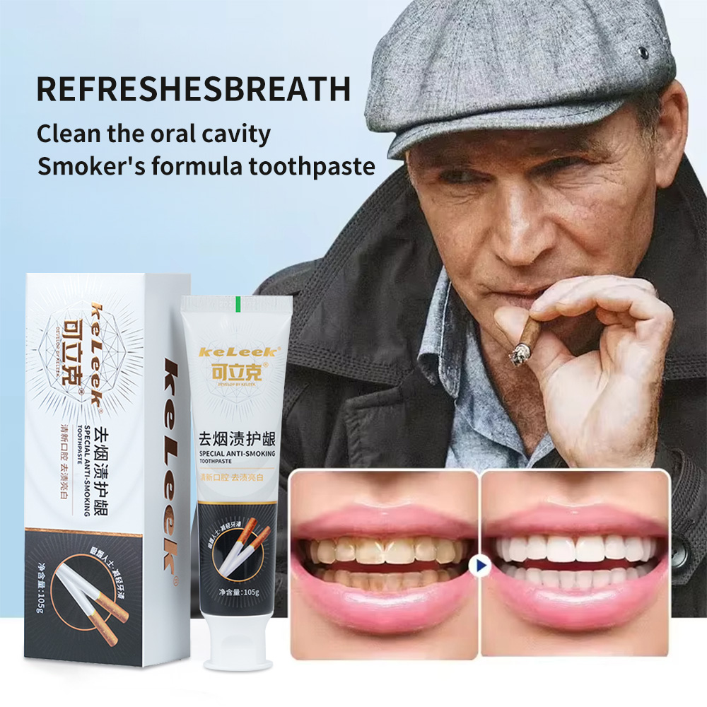Teeth Whitening (Bleaching) - Diş Beyazlatıcı Diş Macunu Sigara Lekelerini