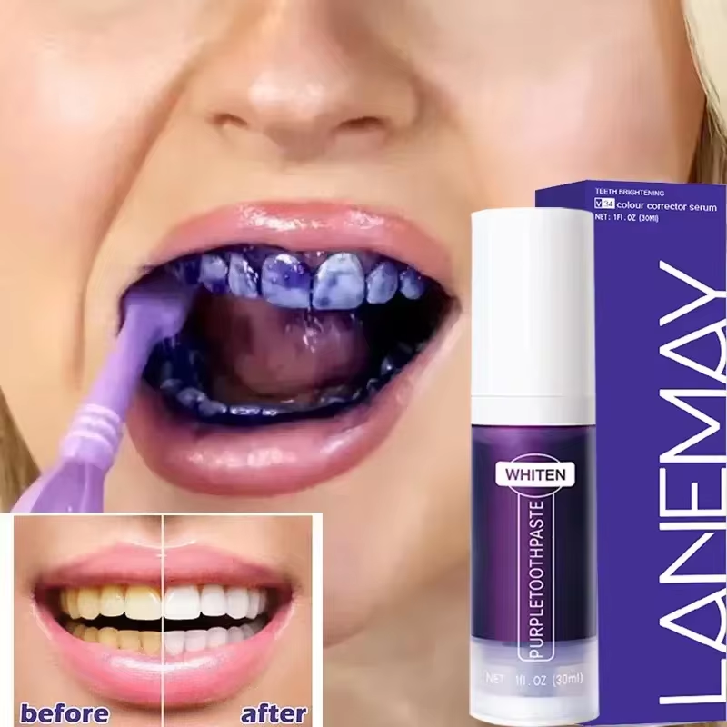 Teeth Whitening Crest - V34 Mor Diş Beyazlatma Diş Macunu