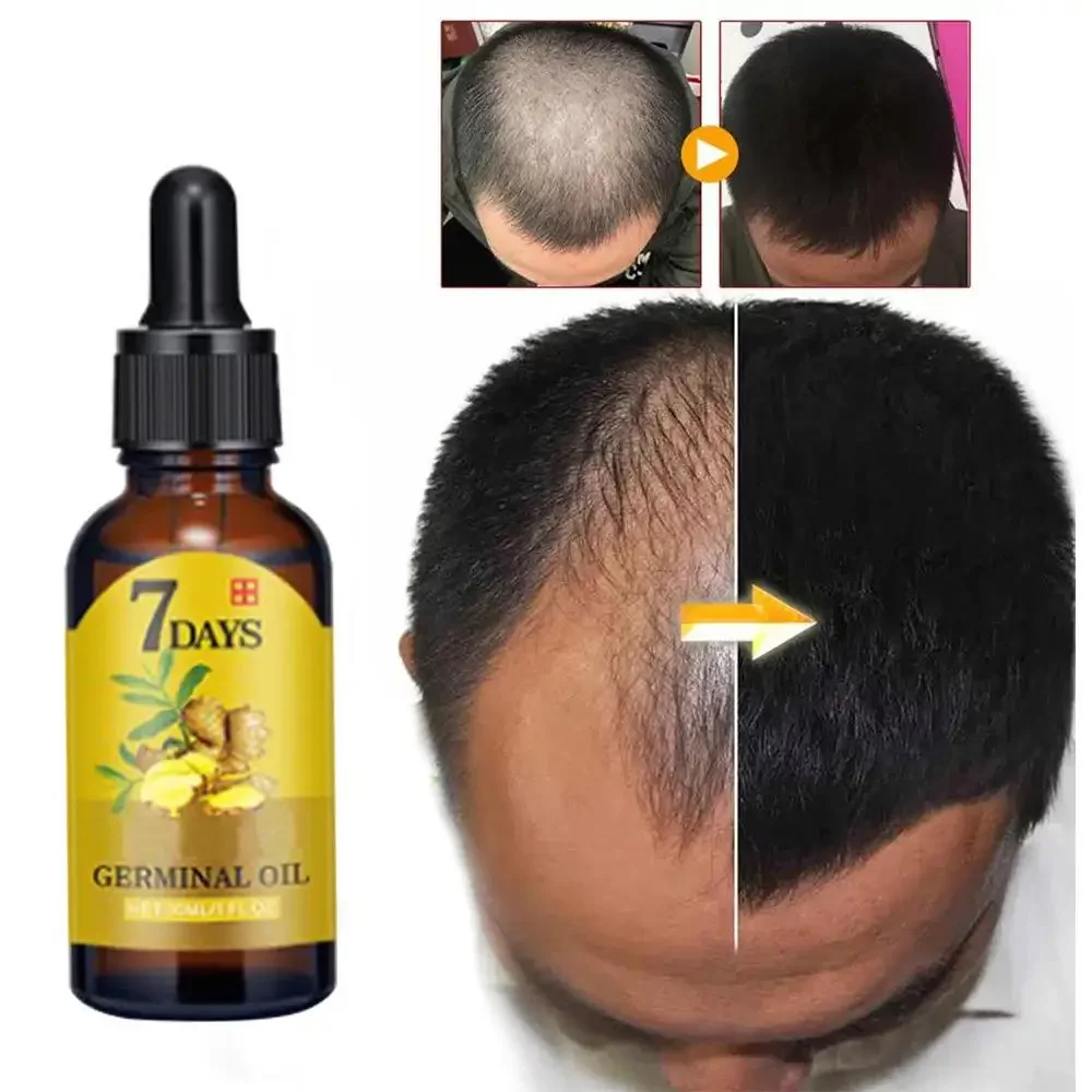 Coconut Oil Pull - Saç Büyüme Zencefil Hızlı Büyüyen Saç