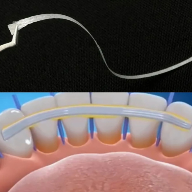 1/2/3/5 Adet Cam Splint Gevşek - Teeth Whitening Strips Lumineux incelemesi ve fiyatı