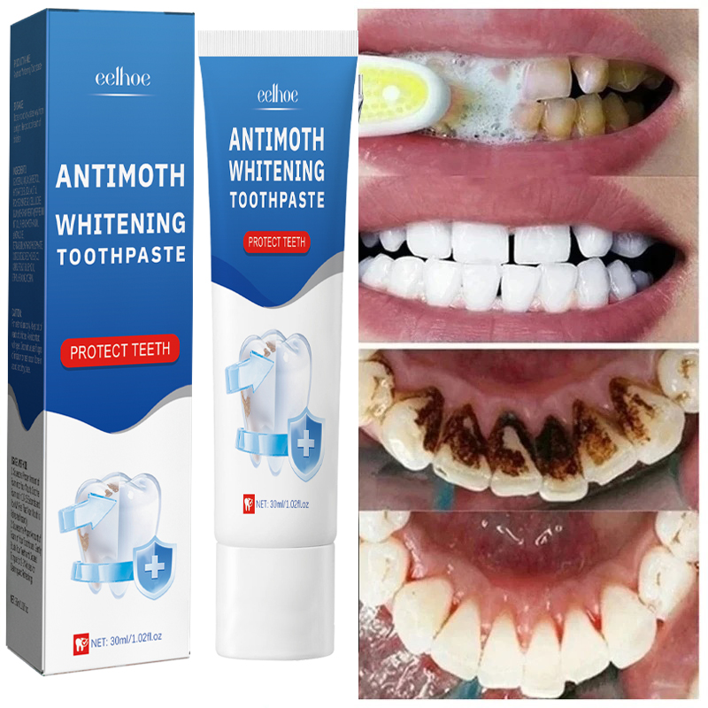 Hızlı Duman Lekelerini Kaldır  - Teeth Whitening Fast incelemesi ve fiyatı