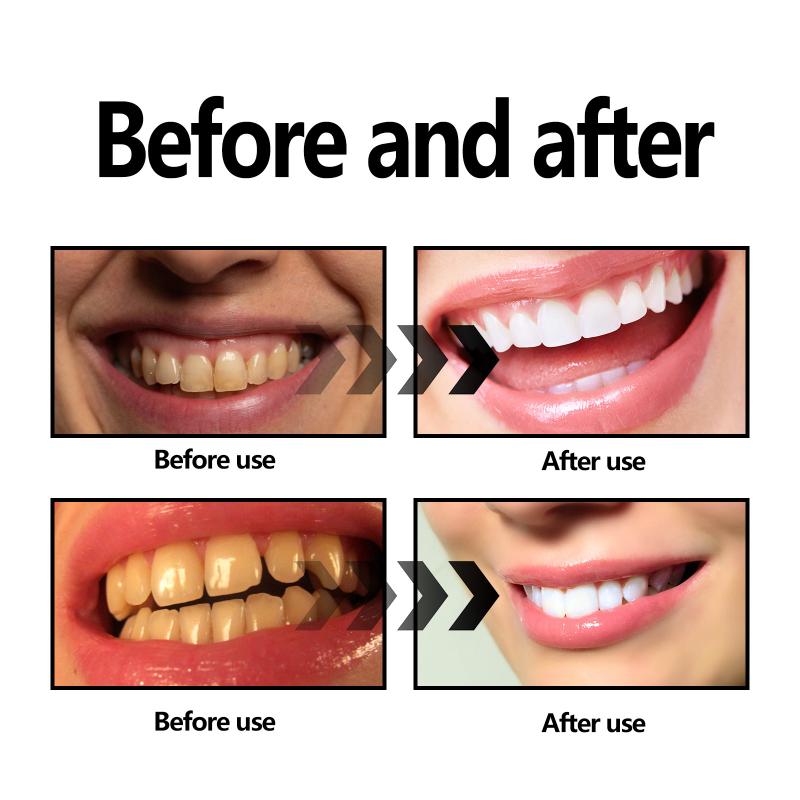Bambu Kömürü Tozu Dişler İçin  - Teeth Whitening Filter incelemesi ve fiyatı