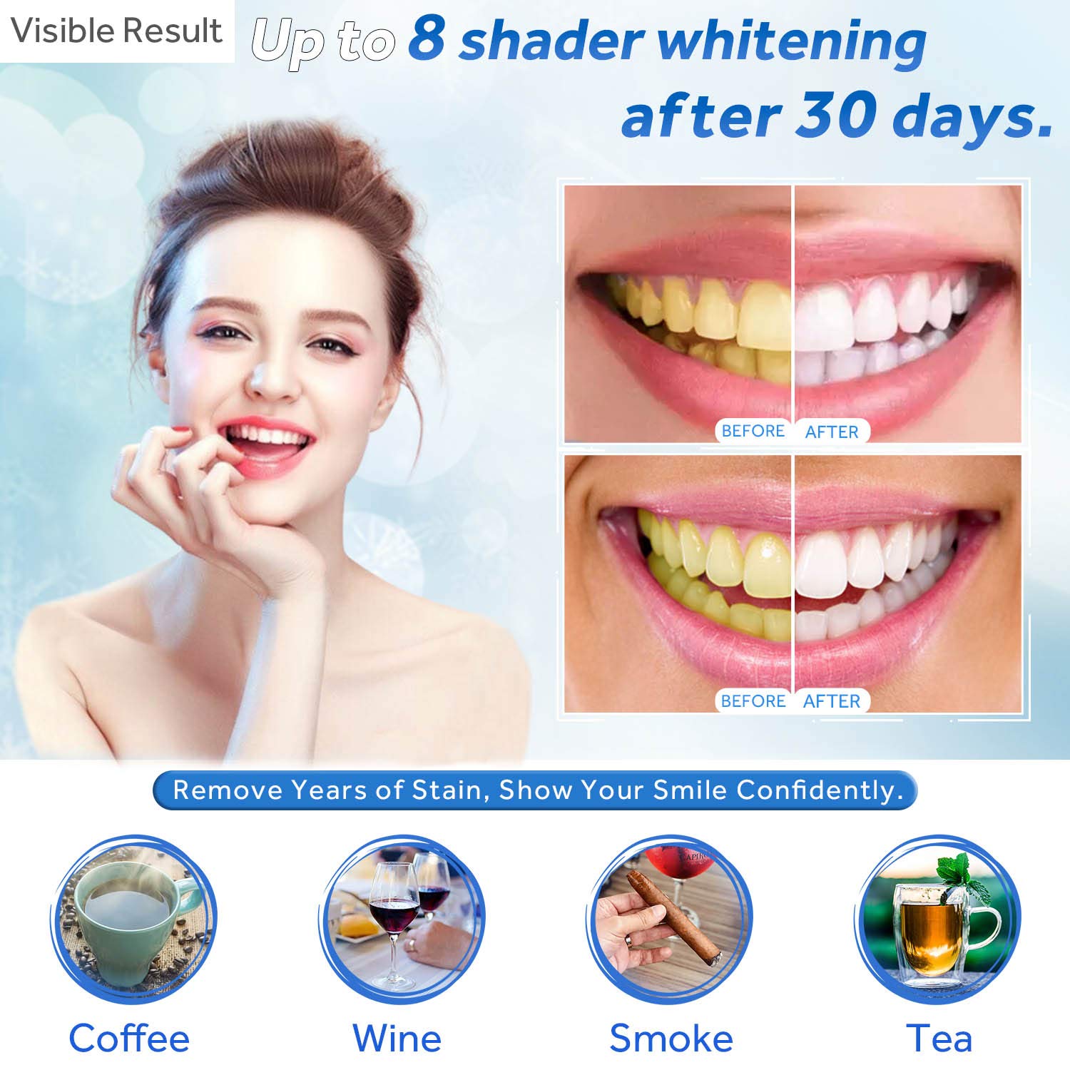 Diş Beyazlatma Jeli Dolum Şırı - Teeth Whitening (Bleaching) incelemesi ve fiyatı