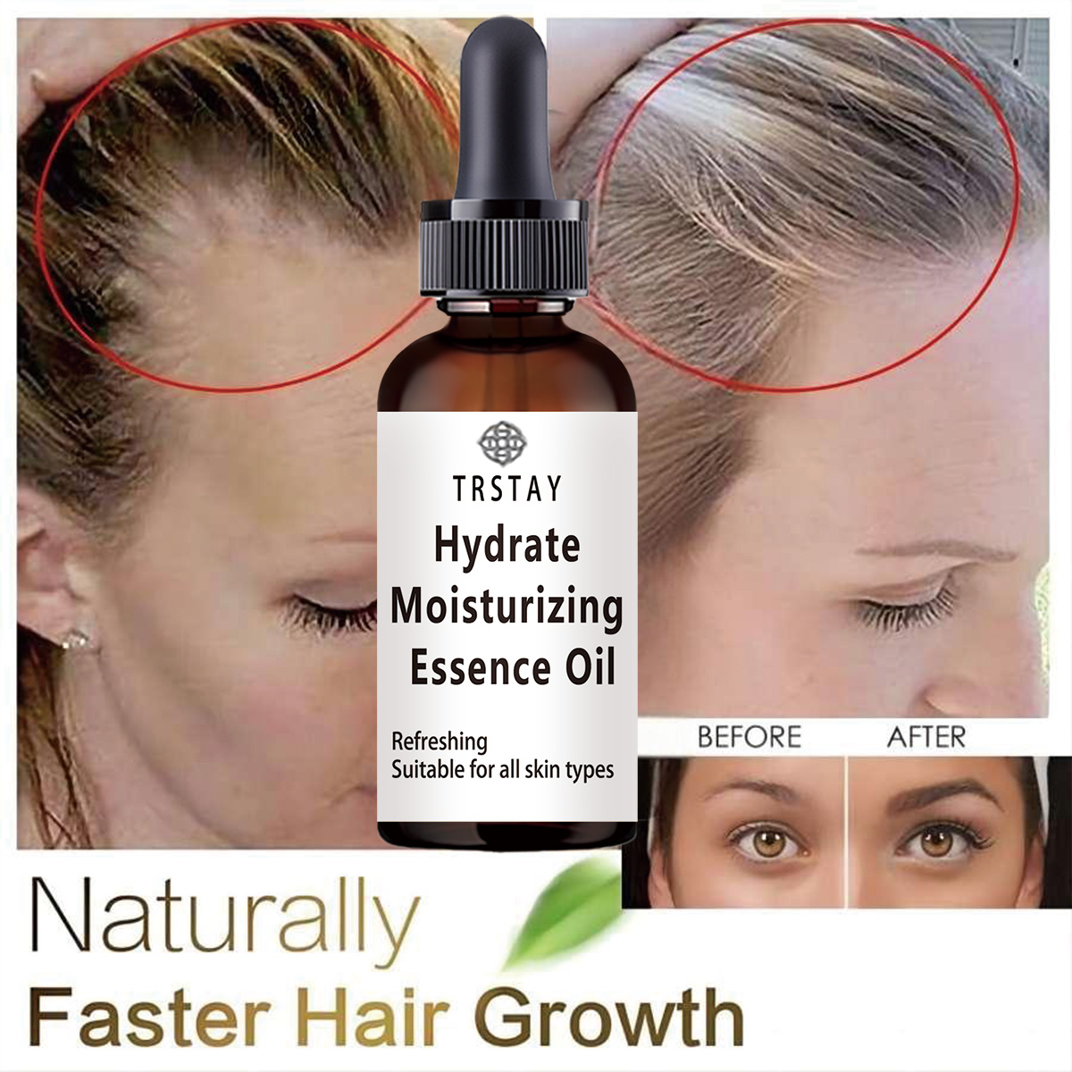 Yeni Hint Yağı Saç Büyüme Uçuc - Coconut Oil Pull incelemesi ve fiyatı