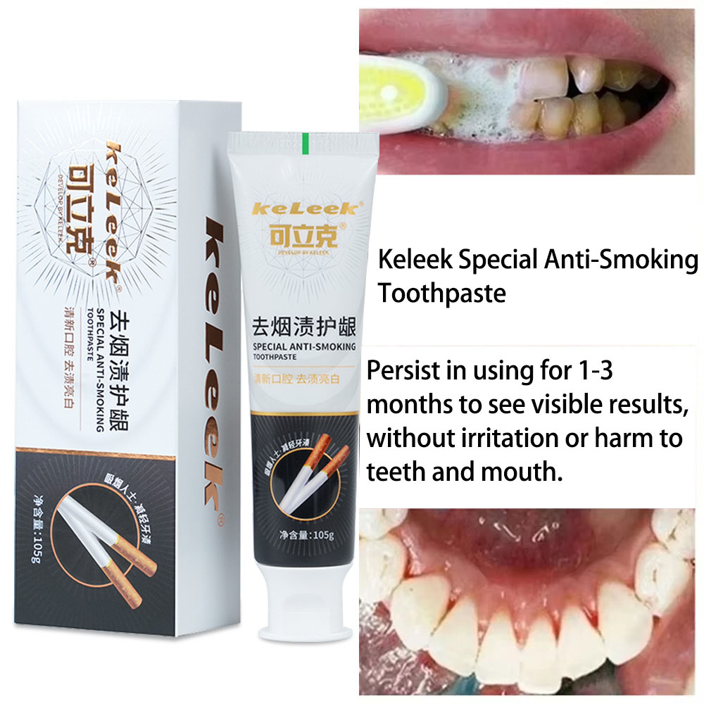 Diş Beyazlatıcı Diş Macunu Sig - Teeth Whitening (Bleaching) incelemesi ve fiyatı