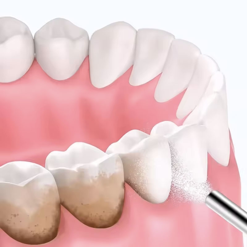130g Diş Beyazlatma Tozu Kumla - Teeth Whitening Zimba incelemesi ve fiyatı