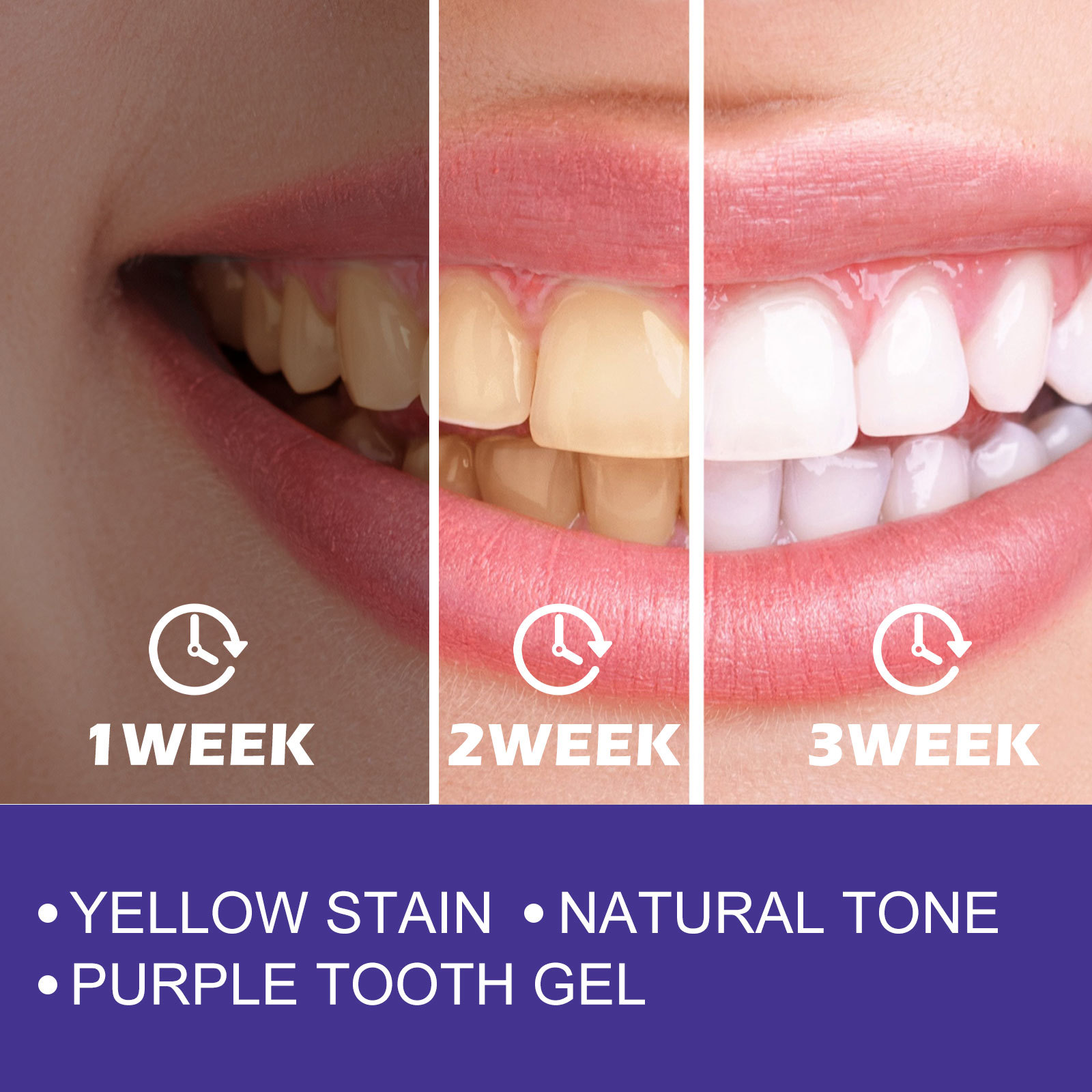 Mor Diş Macunu Diş Beyazlatıcı - Teeth Whitening Crest incelemesi ve fiyatı