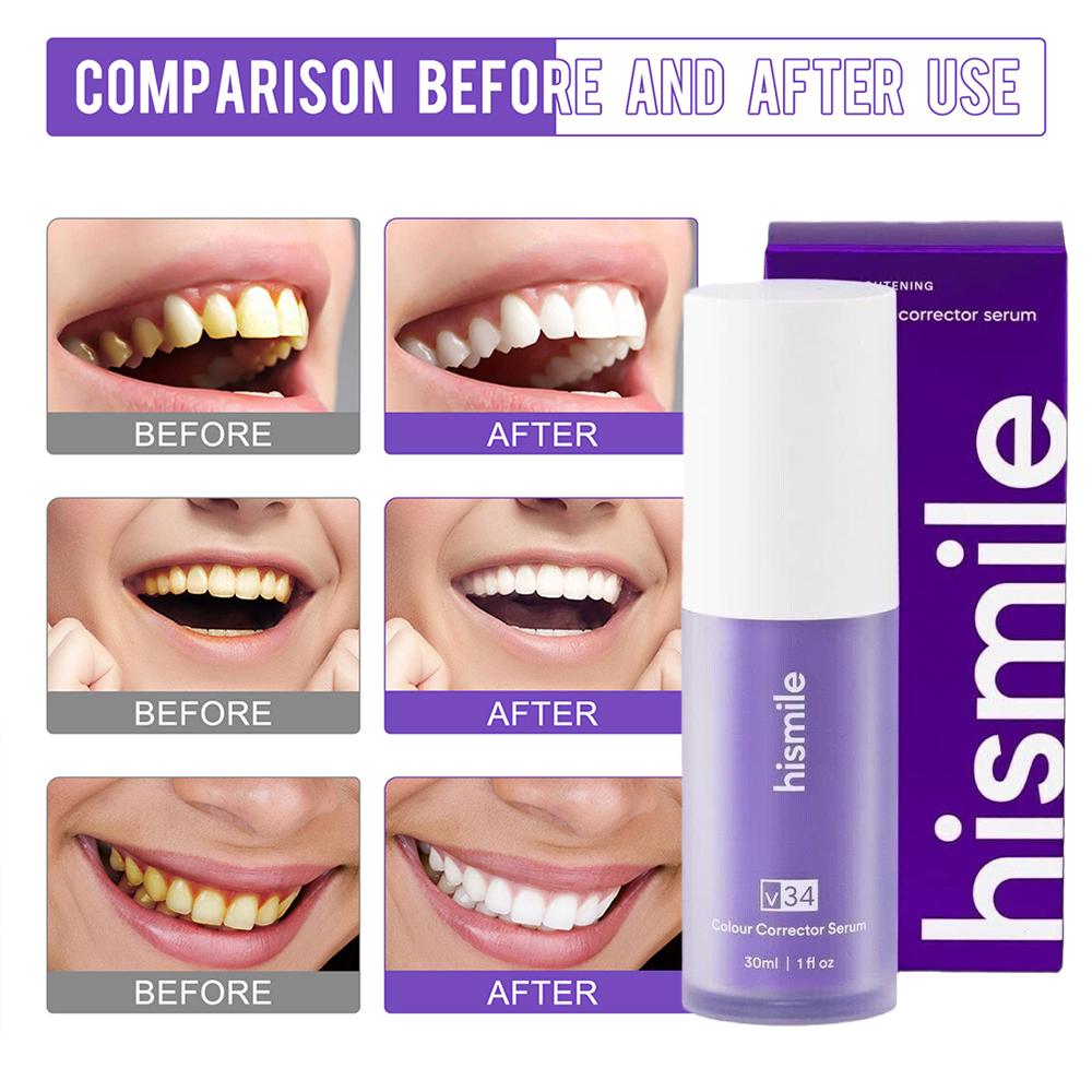    Mor V34 Hismile Diş Beyazl - Teeth Whitening Crest incelemesi ve fiyatı