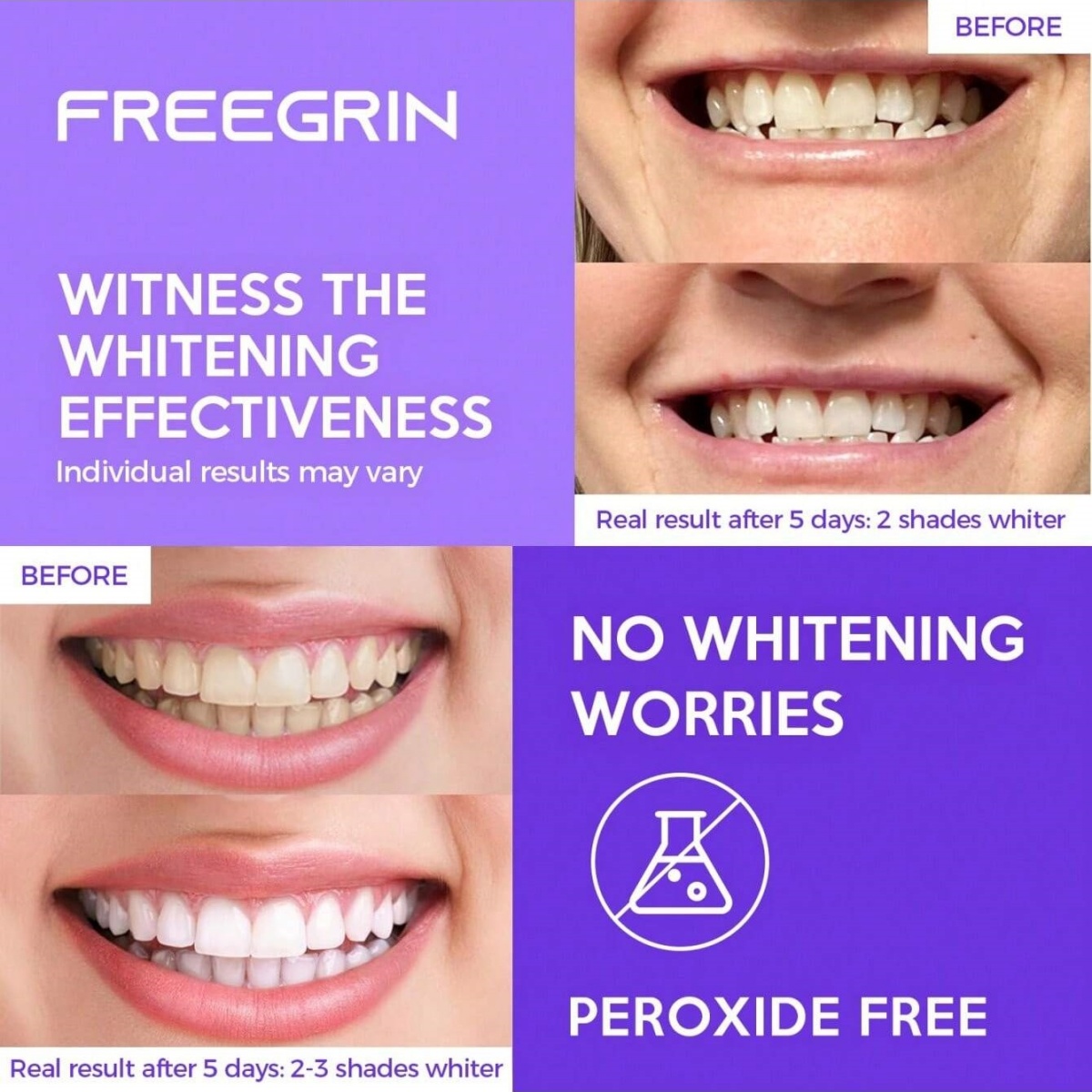 Deluxe Beyazlatma Diş Çıkartma - Teeth Whitening Hydrogen Peroxide incelemesi ve fiyatı