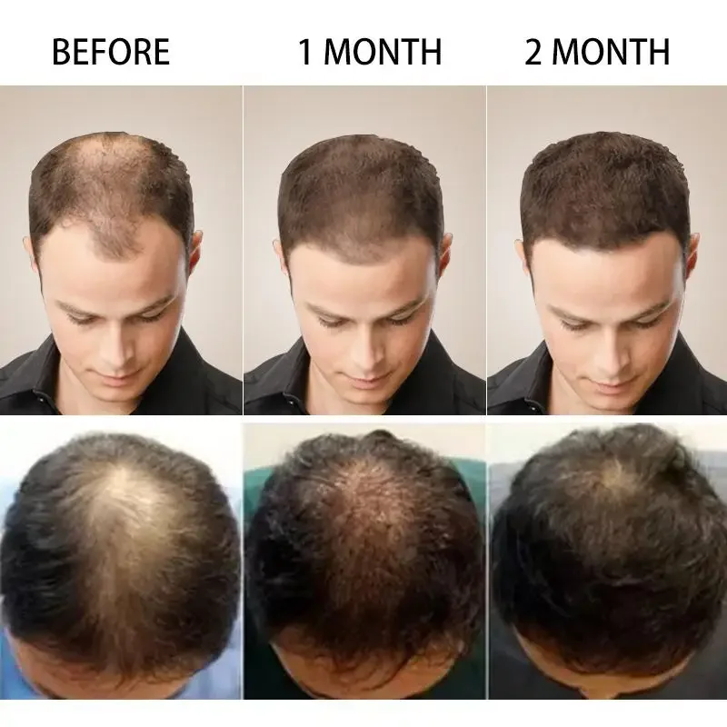 Saç Büyüme Zencefil Hızlı Büyü - Coconut Oil Pull incelemesi ve fiyatı