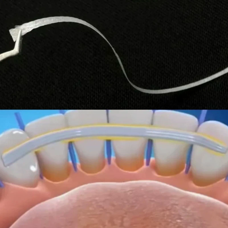 1 adet diş esnek fiber şerit c - Teeth Whitening Strips Lumineux incelemesi ve fiyatı